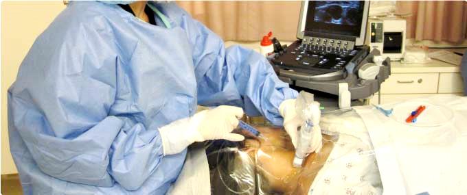 Placing a central venous catheter using ultrasound guidance