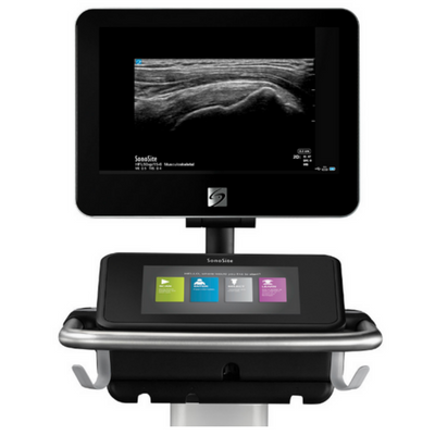 Sonosite X-Porte ultrasound machine