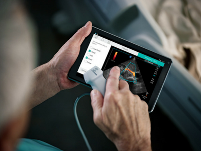 Sonosite ultrasound machines feature intuitive user interfaces and familiar tactile controls